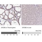 eIF2b beta Antibody in Immunohistochemistry (IHC)