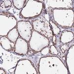 eIF2b beta Antibody in Immunohistochemistry (IHC)