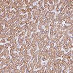 ZNF584 Antibody in Immunohistochemistry (Paraffin) (IHC (P))