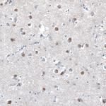 TDE1 Antibody in Immunohistochemistry (Paraffin) (IHC (P))