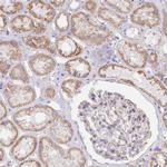 TDE1 Antibody in Immunohistochemistry (Paraffin) (IHC (P))