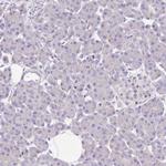 TDE1 Antibody in Immunohistochemistry (Paraffin) (IHC (P))