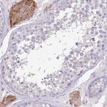 TDE1 Antibody in Immunohistochemistry (IHC)