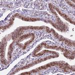 GSTO2 Antibody in Immunohistochemistry (Paraffin) (IHC (P))