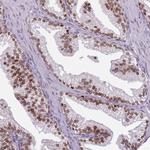 GSTO2 Antibody in Immunohistochemistry (Paraffin) (IHC (P))