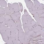 GSTO2 Antibody in Immunohistochemistry (Paraffin) (IHC (P))