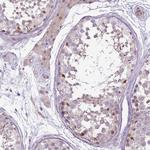 GSTO2 Antibody in Immunohistochemistry (Paraffin) (IHC (P))