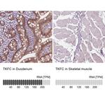 DAK Antibody in Immunohistochemistry (IHC)