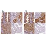 DAK Antibody in Immunohistochemistry (IHC)