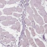 DAK Antibody in Immunohistochemistry (IHC)