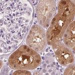 DAK Antibody in Immunohistochemistry (IHC)