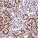 PAPD5 Antibody in Immunohistochemistry (IHC)