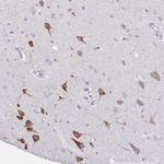 Argonaute 3 Antibody in Immunohistochemistry (Paraffin) (IHC (P))