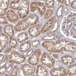 EDEM2 Antibody in Immunohistochemistry (Paraffin) (IHC (P))