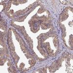 EDEM2 Antibody in Immunohistochemistry (Paraffin) (IHC (P))