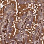 EDEM2 Antibody in Immunohistochemistry (IHC)