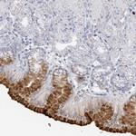 RAB33B Antibody in Immunohistochemistry (Paraffin) (IHC (P))