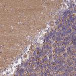 AP3M1 Antibody in Immunohistochemistry (Paraffin) (IHC (P))