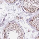 UBXN7 Antibody in Immunohistochemistry (IHC)