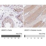 UBXN7 Antibody