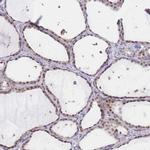 UBXN7 Antibody in Immunohistochemistry (IHC)