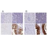 LZTFL1 Antibody in Immunohistochemistry (IHC)