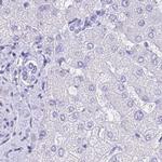 LZTFL1 Antibody in Immunohistochemistry (IHC)