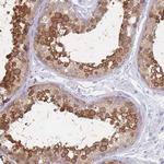 LZTFL1 Antibody in Immunohistochemistry (IHC)