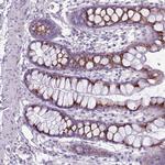 DBF4B Antibody in Immunohistochemistry (Paraffin) (IHC (P))