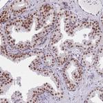 ZBED5 Antibody in Immunohistochemistry (Paraffin) (IHC (P))