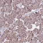 MRPS9 Antibody in Immunohistochemistry (IHC)