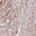 MRPS9 Antibody in Immunohistochemistry (IHC)