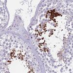 SPAG4L Antibody in Immunohistochemistry (Paraffin) (IHC (P))