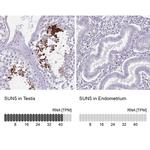 SPAG4L Antibody in Immunohistochemistry (IHC)