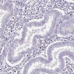 SPAG4L Antibody in Immunohistochemistry (IHC)