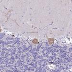 MTSS1L Antibody in Immunohistochemistry (Paraffin) (IHC (P))