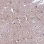 MTSS1L Antibody in Immunohistochemistry (Paraffin) (IHC (P))