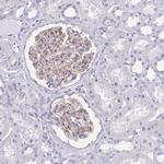 MTSS1L Antibody in Immunohistochemistry (Paraffin) (IHC (P))