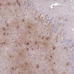 MTSS1L Antibody in Immunohistochemistry (IHC)