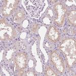 TMEM27 Antibody in Immunohistochemistry (Paraffin) (IHC (P))