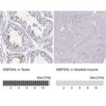 WBP2NL Antibody in Immunohistochemistry (IHC)