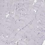 WBP2NL Antibody in Immunohistochemistry (IHC)