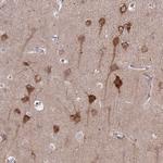 ASAP1 Antibody in Immunohistochemistry (Paraffin) (IHC (P))