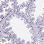 ASAP1 Antibody in Immunohistochemistry (Paraffin) (IHC (P))