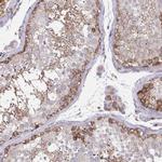 ASAP1 Antibody in Immunohistochemistry (Paraffin) (IHC (P))