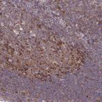 ASAP1 Antibody in Immunohistochemistry (Paraffin) (IHC (P))