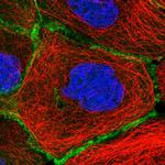 Erbin Antibody in Immunocytochemistry (ICC/IF)