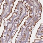 Erbin Antibody in Immunohistochemistry (Paraffin) (IHC (P))