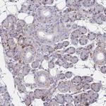 Erbin Antibody in Immunohistochemistry (Paraffin) (IHC (P))