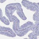 MAT1A Antibody in Immunohistochemistry (Paraffin) (IHC (P))